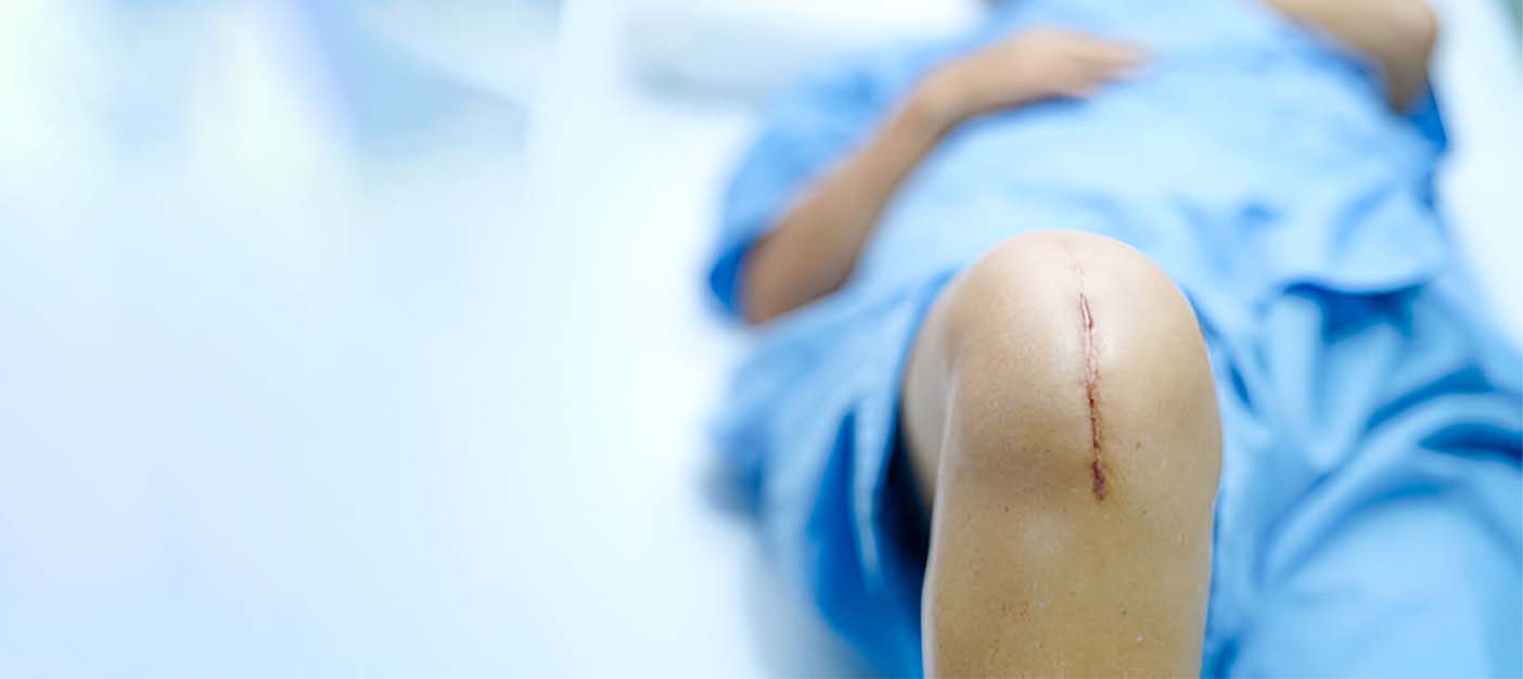 Types Of Knee Surgery And Their Recovery Times: What You Need To Know